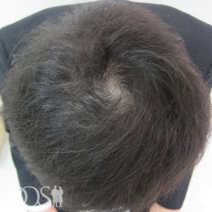 20代 男性