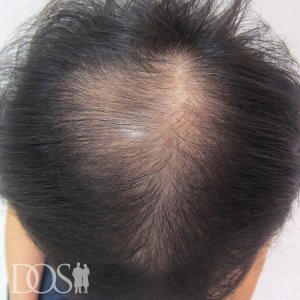 20代 男性