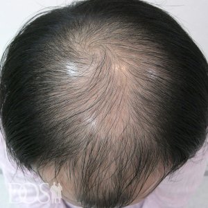 33歳 男性