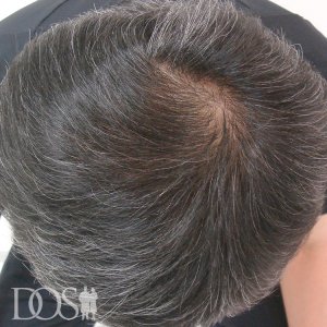 50歳 男性
