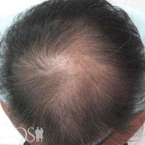 54歳 男性