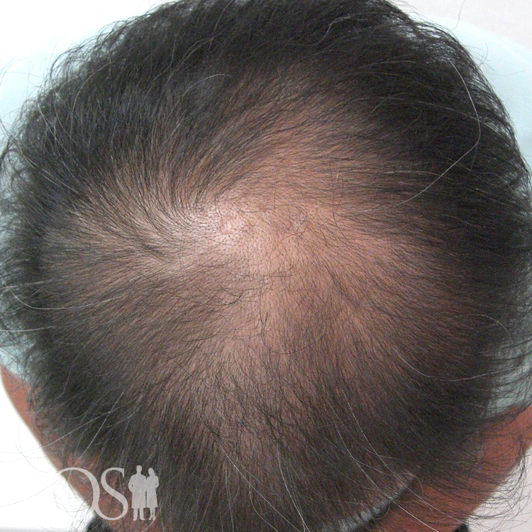 54歳 男性