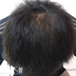 40代 タレントT