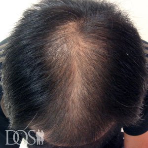 40代 タレントT