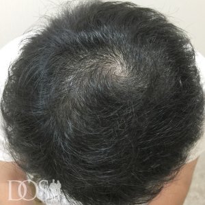 20代 男性