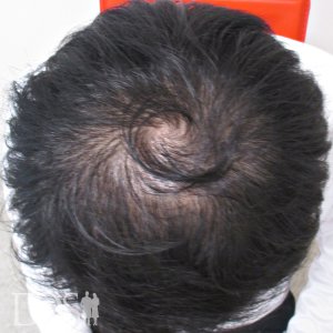 20代 男性