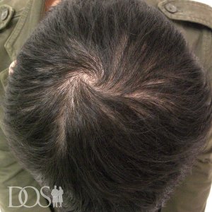 23歳 男性