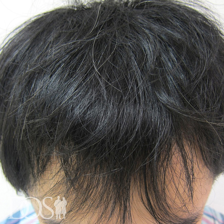 39歳 男性
