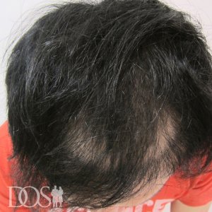 31歳 男性