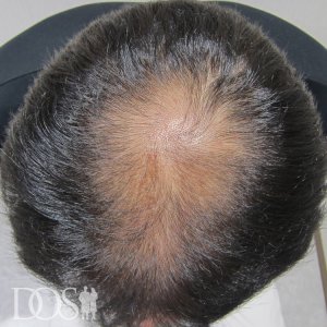 54歳 男性