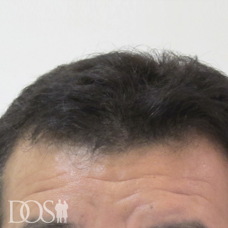 52歳 男性