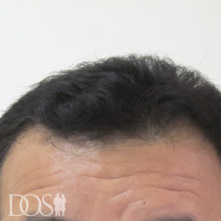 52歳 男性
