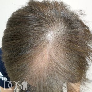 58歳 男性
