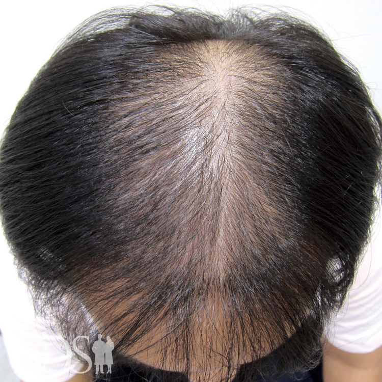 20代後半 男性