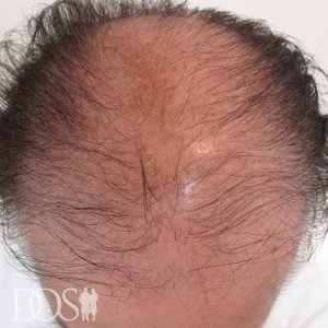 58歳男性