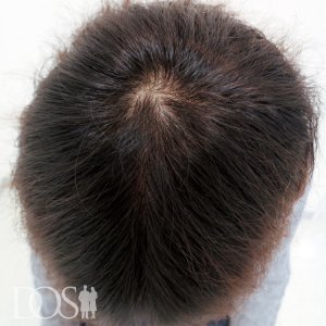 23歳 男性