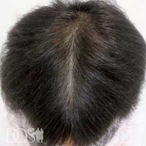 38歳 男性