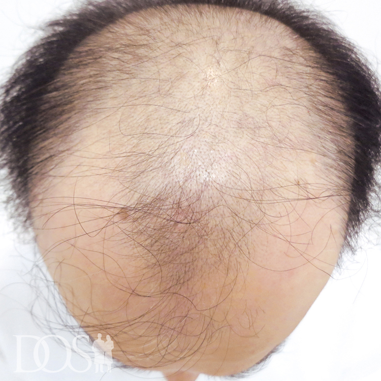 53歳 男性