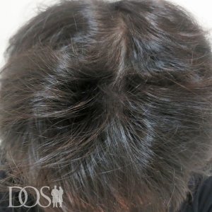 30代 男性