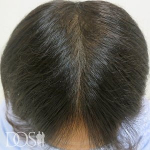 30代 男性