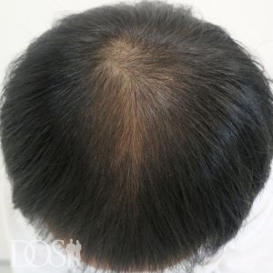 39歳 男性
