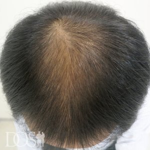 39歳 男性