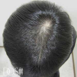 20代男性