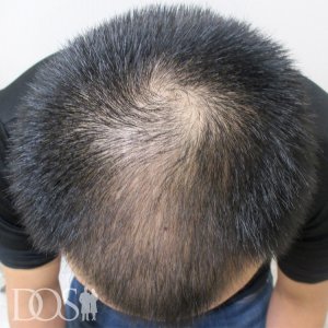30代男性
