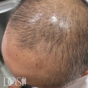47歳 男性