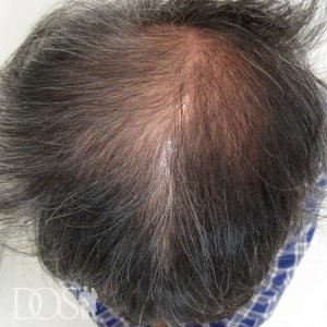 50歳 男性