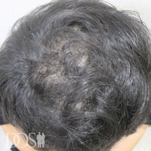 30代 男性