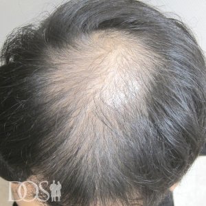 30代 男性