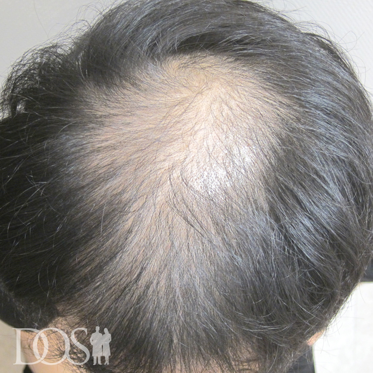 30代 男性