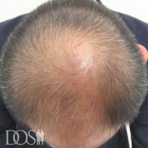 40代 男性