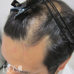 36歳 男性