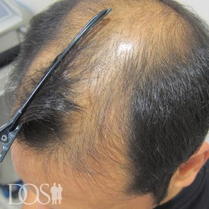 36歳 男性
